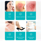 DermaSeal Pimple Patch Roll | Hydrocolloid Dressing